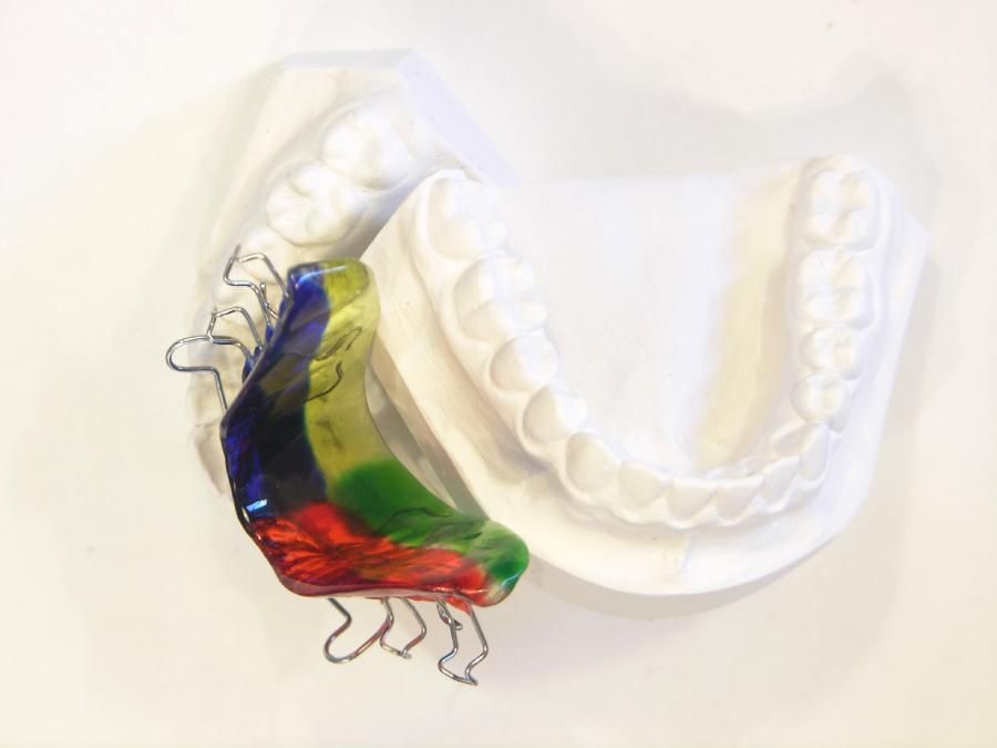 Kieferorthopädische Apparatur